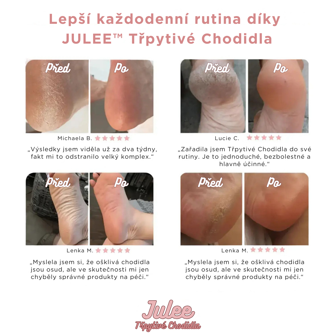 JULEE™ – Třpytivé Chodidla