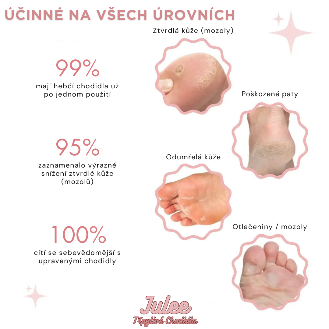 JULEE™ – Třpytivé Chodidla